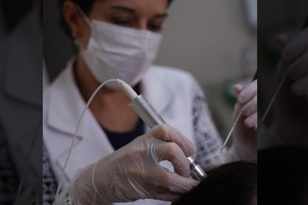 Microagulhamento robótico: um grande aliado no tratamento da pele e capilar